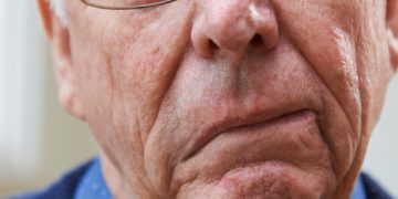 #最简单，最容易学，家人最容易操作的中风复健方法！