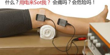 【物理治疗仪器篇】电疗到底有什么功能？