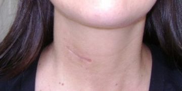 PAIN, PAIN, PAINChill out and take a breath. Read this story.