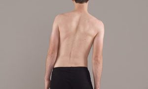 腰痛到身体歪掉！